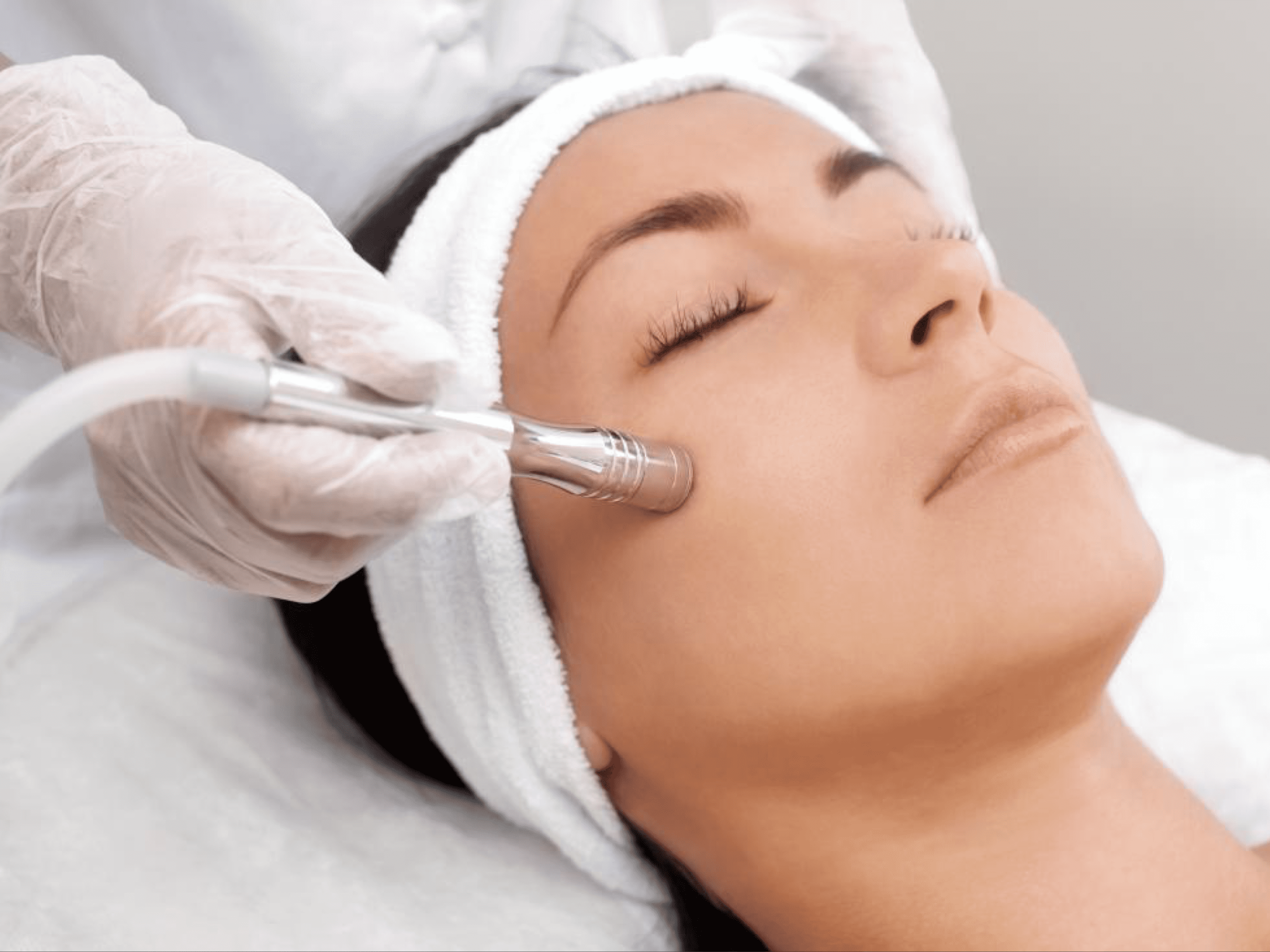 microdermabrasion